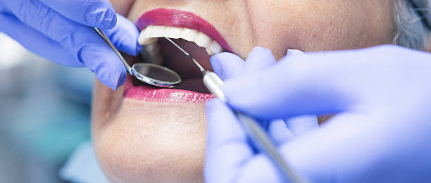 Best Emergency Tooth Extraction in Burnham, PA
